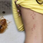 Bed-bugs-Signs-you-have-bed-bugs-1165260